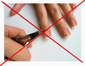 le cuticole le cuticole