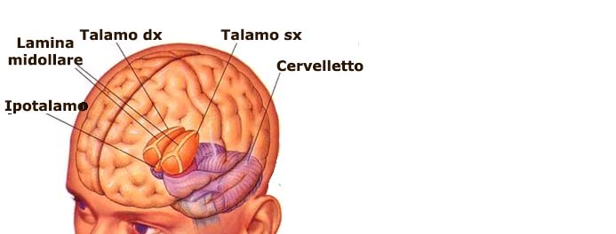 talamo